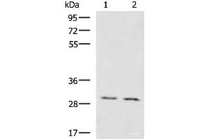 Western blot analysis of Mouse brain tissue Mouse kidney tissue lysates using KRCC1 Polyclonal Antibody at dilution of 1:1350 (KRCC1 抗体)