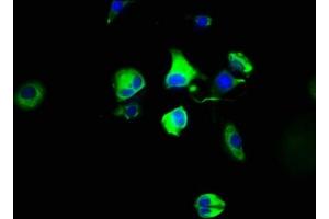 Immunofluorescence staining of MCF-7 cells with ABIN7142640 at 1:100, counter-stained with DAPI. (Serotonin Receptor 4 抗体  (AA 316-388))