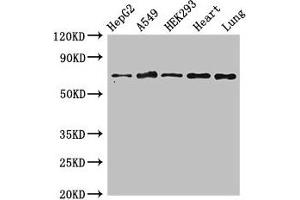 Western Blot Positive WB detected in: HepG2 whole cell lysate, A549 whole cell lysate, HEK293 whole cell lysate, Rat heart tissue, Rat lung tissue All lanes: EIF2AK1 antibody at 3 μg/mL Secondary Goat polyclonal to rabbit IgG at 1/50000 dilution Predicted band size: 72 kDa Observed band size: 72 kDa (EIF2AK1 抗体  (AA 1-86))