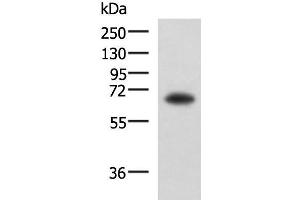 Western blot analysis of PC3 cell lysate using SHC3 Polyclonal Antibody at dilution of 1:650 (SHC3 抗体)