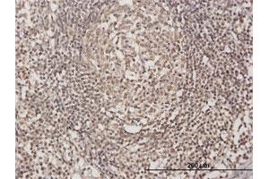 Immunoperoxidase of purified MaxPab antibody to OLIG3 on formalin-fixed paraffin-embedded human lymph node. (OLIG3 抗体  (AA 1-272))
