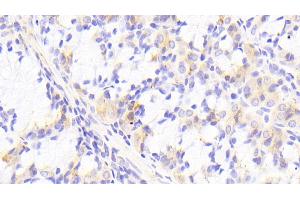 Detection of PTPRK in Human Stomach Tissue using Polyclonal Antibody to Protein Tyrosine Phosphatase Receptor Type K (PTPRK) (PTPRK 抗体  (AA 1185-1440))