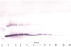 Western Blot (Reduced) using TSLP antibody (Thymic Stromal Lymphopoietin 抗体)