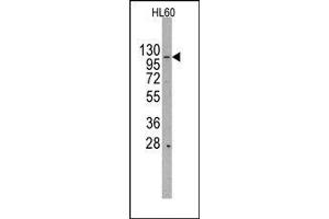 Image no. 1 for anti-HIR Histone Cell Cycle Regulation Defective Homolog A (HIRA) (Middle Region) antibody (ABIN358780) (HIRA 抗体  (Middle Region))