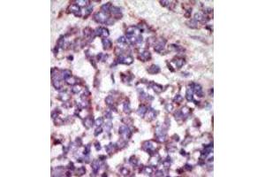 Immunohistochemistry (Paraffin-embedded Sections) (IHC (p)) image for anti-LATS, Large Tumor Suppressor, Homolog 1 (Drosophila) (LATS1) (N-Term) antibody (ABIN359091)