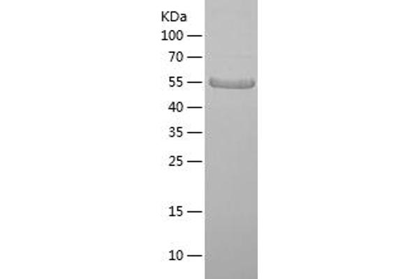 FURIN Protein (AA 108-371) (His-IF2DI Tag)