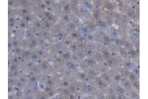 Immunohistochemistry (IHC) image for anti-Sterol Carrier Protein 2 (SCP2) (AA 433-547) antibody (ABIN5014353)
