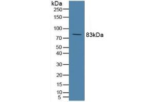 Detection of C2 in Rat Serum using Polyclonal Antibody to Complement Component 2 (C2) (Complement C2 抗体  (AA 473-723))