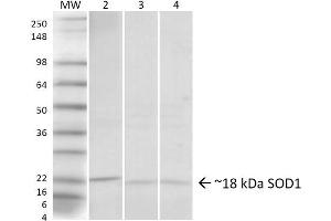 Western blot analysis of Human, Rat, Mouse Hela cells, Brain, Lung showing detection of ~18 kDa SOD1 (UBB) protein using Rabbit Anti-SOD1 (UBB) Polyclonal Antibody . (SOD1 抗体  (N-Term) (HRP))