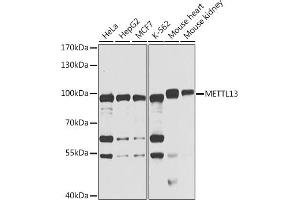 Western blot analysis of extracts of various cell lines, using METTL13 antibody (ABIN6131843, ABIN6143756, ABIN6143758 and ABIN6222922) at 1:1000 dilution. (METTL13 抗体  (AA 540-699))