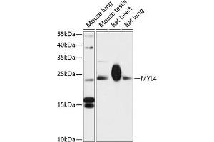 Western blot analysis of extracts of various cell lines, using MYL4 antibody (ABIN6129614, ABIN6144252, ABIN6144254 and ABIN6217179) at 1:3000 dilution. (MYL4 抗体  (AA 1-197))