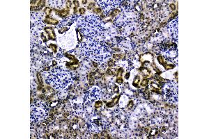 IHC analysis of VCAM1 using anti-VCAM1 antibody . (VCAM1 抗体  (AA 25-270))