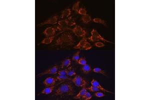 Immunofluorescence analysis of C6 cells using HPS4 antibody (ABIN7267623) at dilution of 1:100. (HPS4 抗体  (AA 550-650))