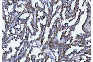 IHC analysis of Axin 2/AXIN2 using anti-Axin 2/AXIN2 antibody (ABIN7602177). (AXIN2 抗体  (AA 614-843))