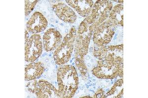 Immunohistochemistry of paraffin-embedded rat kidney using PLS1 antibody (ABIN7269391) at dilution of 1:100 (40x lens). (PLS1 抗体  (AA 1-110))