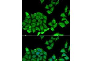 Immunofluorescence analysis of U2OS cells using RPS7 Polyclonal Antibody (RPS7 抗体)