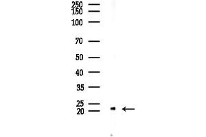 Western blot analysis of lysates from Mouse testis, using SM22 alpha Antibody at 1/1000 dilution.