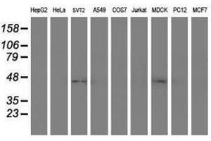 Image no. 2 for anti-serpin Peptidase Inhibitor, Clade A (Alpha-1 Antiproteinase, Antitrypsin), Member 5 (SERPINA5) antibody (ABIN1500058)