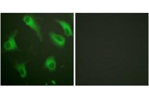 Immunofluorescence analysis of HeLa cells, using CD88/C5aR (Ab-338) Antibody. (C5AR1 抗体  (AA 301-350))
