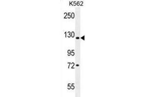 Western Blotting (WB) image for anti-Lysine (K)-Specific Demethylase 4C (KDM4C) antibody (ABIN2996198) (KDM4C 抗体)