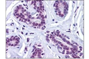 Human Breast: Formalin-Fixed, Paraffin-Embedded (FFPE) (Retinoblastoma Binding Protein 8 抗体)