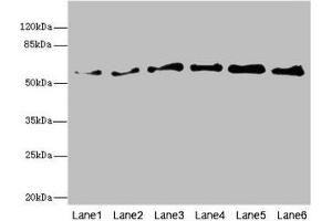 Western blot All lanes: PIP5K1B antibody at 5. (PIP5K1B 抗体  (AA 190-470))