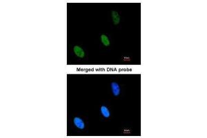 ICC/IF Image Immunofluorescence analysis of paraformaldehyde-fixed HeLa, using ZHX2, antibody at 1:200 dilution. (ZHX2 抗体  (C-Term))