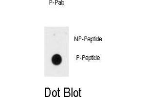 Image no. 1 for anti-Insulin Receptor (INSR) (pTyr1185) antibody (ABIN358482) (Insulin Receptor 抗体  (pTyr1185))