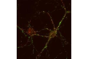 Indirect immunolabeling of PFA fixed rat hippocampus neurons with anti-synapsin 3 (1 : 500; red) and mouse anti-synapsin 1 (cat. (Synapsin III 抗体  (AA 417-434))