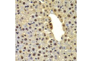 Immunohistochemistry of paraffin-embedded mouse liver using DTX2 antibody (ABIN6127799, ABIN6139853, ABIN6139854 and ABIN6223266) at dilution of 1:100 (40x lens). (DTX2 抗体  (AA 1-280))