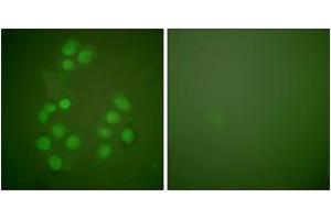 Immunofluorescence analysis of A549 cells, using CREB-BP Antibody. (CBP 抗体  (AA 2393-2442))