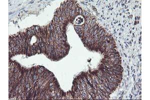 Immunohistochemistry (IHC) image for anti-TNF Receptor-Associated Protein 1 (TRAP1) antibody (ABIN1501500)