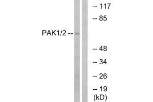 Western Blotting (WB) image for anti-P21 Protein (Cdc42/Rac)-Activated Kinase 1/2 (PAK1/2) (Ser199) antibody (ABIN1848058) (PAK1/2 抗体  (Ser199))