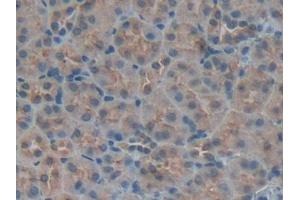Used in DAB staining on fromalin fixed paraffin- embedded kidney tissue (IGFBP5 抗体  (AA 25-271))