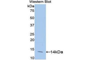Western Blotting (WB) image for anti-Eukaryotic Translation Initiation Factor 4E Binding Protein 1 (EIF4EBP1) (AA 2-118) antibody (ABIN3202359) (eIF4EBP1 抗体  (AA 2-118))