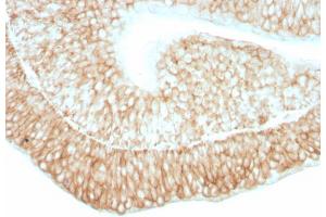 Formalin-fixed, paraffin-embedded human bladder stained with CD59 Mouse Monoclonal Antibody (193-27). (CD59 抗体)