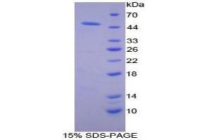 SDS-PAGE analysis of Human Adiponectin Receptor 2 Protein. (Adiponectin Receptor 2 Protein (ADIPOR2))