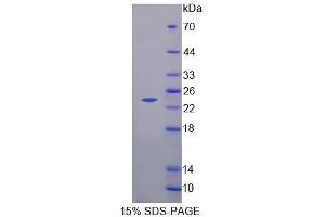 SDS-PAGE analysis of Human NCALd Protein. (NCALD 蛋白)
