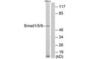 Western blot analysis of extracts from HeLa cells, using Smad1/5/9 Antibody. (SMAD1 抗体  (AA 10-59))