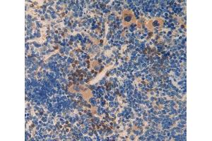 Used in DAB staining on fromalin fixed paraffin- embedded spleen tissue (SMAD6 抗体  (AA 171-441))