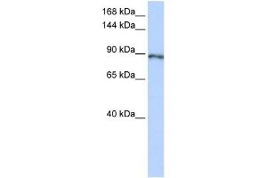 WB Suggested Anti-SOLH Antibody Titration:  0. (Calpain 15/SOLH 抗体  (Middle Region))