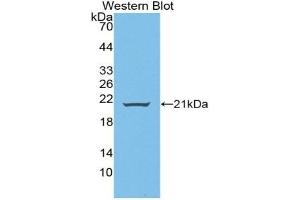 Detection of Recombinant WNT11, Human using Polyclonal Antibody to Wingless Type MMTV Integration Site Family, Member 11 (WNT11) (WNT11 抗体  (AA 204-349))