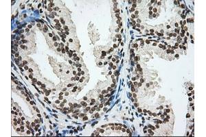Immunohistochemical staining of paraffin-embedded Human Kidney tissue using anti-CYP1A2 mouse monoclonal antibody. (CYP1A2 抗体)