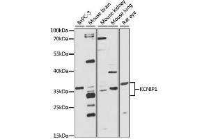 Western blot analysis of extracts of various cell lines, using KCNIP1 antibody (ABIN1873379) at 1:1000 dilution. (KCNIP1 抗体)