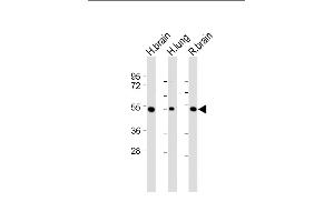 Western Blotting (WB) image for anti-Dual Specificity Phosphatase 6 (DUSP6) (AA 58-89) antibody (ABIN392864)
