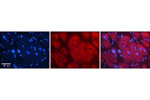Rabbit Anti-Hdac6 Antibody    Formalin Fixed Paraffin Embedded Tissue: Human Adult heart  Observed Staining: Cytoplasmic Primary Antibody Concentration: 1:600 Secondary Antibody: Donkey anti-Rabbit-Cy2/3 Secondary Antibody Concentration: 1:200 Magnification: 20X Exposure Time: 0.