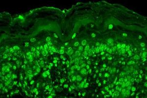Immunohistochemistry (IHC) image for anti-Calcium Channel, Voltage-Dependent, beta 2 Subunit (CACNB2) (AA 189-205) antibody (Atto 390) (ABIN2485028)