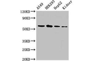 Western Blot Positive WB detected in: A549 whole cell lysate, HEK293 whole cell lysate, HepG2 whole cell lysate, Rat kidney tissue All lanes: P4HA1 antibody at 2.