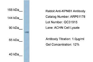 Western Blotting (WB) image for anti-Karyopherin (Importin) beta 1 (KPNB1) (N-Term) antibody (ABIN2788708) (KPNB1 抗体  (N-Term))