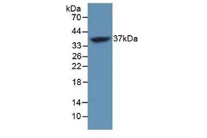 Detection of Recombinant FOSL1, Mouse using Polyclonal Antibody to FOS Like Antigen 1 (FOSL1) (FOSL1 抗体  (AA 1-273))